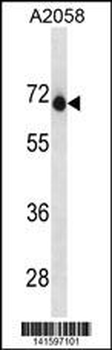 ENDOD1 Antibody(Center)