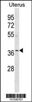 OR5W2 Antibody(C-term)