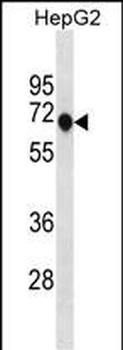 ANKDD1A Antibody(C-term)