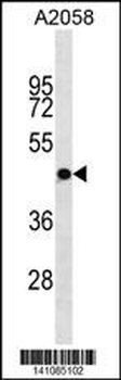 OR4S1 Antibody(C-term)