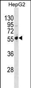 PSMD5 Antibody(C-term)