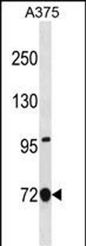 ANXA6 Antibody(C-term)