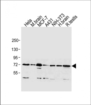 MTA1 Antibody(C-term)