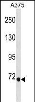 EOMES Antibody(N-term)