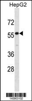 IL17RE Antibody(N-term)