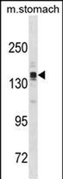 ASTN2 Antibody(N-term)