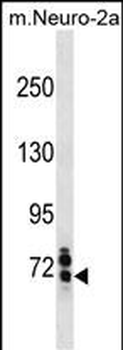 Mouse Senp1 Antibody(Center)