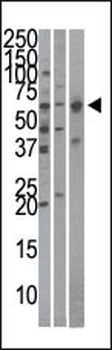 Importin alpha-3 (KPNA4)Antibody (C-term)