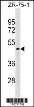 OR1S2 Antibody(C-term)
