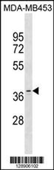 OR11A1 Antibody(C-term)