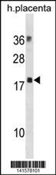 MYL12B Antibody(N-term)