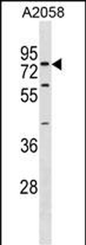 SYT16 Antibody(Center)