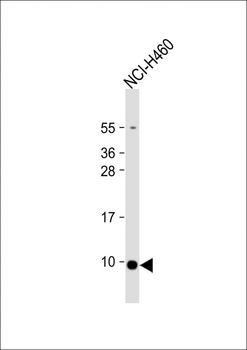 CCL17 Antibody(C-term)