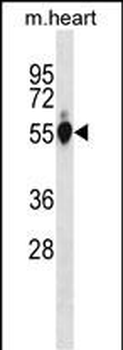 Mouse Gpi Antibody(C-term)