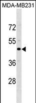 CCR5 Antibody(Center)