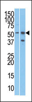 RMP (URI) Antibody (C-term)