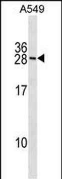 RNF182 Antibody(N-term)