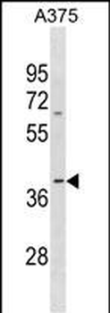 OR13D1 Antibody(C-term)