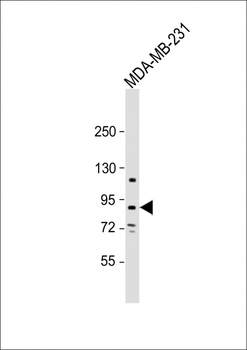 TROAP Antibody(N-term)