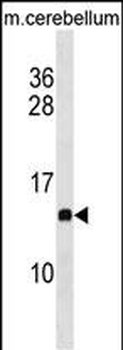 PFDN2 Antibody(C-term)