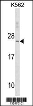 TNNC2 Antibody(C-term)