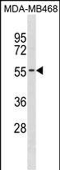 KCNK6 Antibody(C-term)