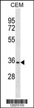 OR2A12 Antibody(C-term)