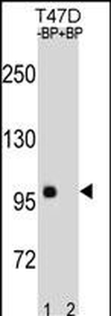 CTNNB1 Antibody(C-term)