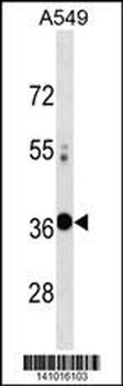 VAX2 Antibody(Center)