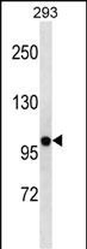 KCNB2 Antibody(N-term)