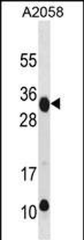 RAET1E Antibody(Center)