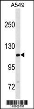 GTF2IRD2B Antibody(C-term)