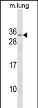 RBM7 Antibody(C-term)