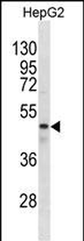 GABRR1 Antibody(N-term)