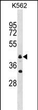 RNF175 Antibody(Center)