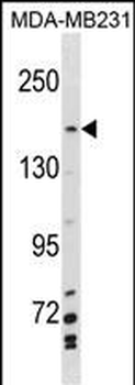 MYBBP1A Antibody(N-term)