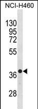 CXCR4 Antibody(N-term)