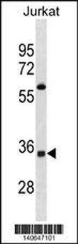 OR52A5 Antibody(C-term)