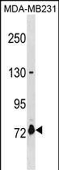 ASNSD1 Antibody(Center)