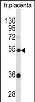 TEKT3 Antibody(N-term)