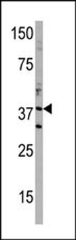 DIMT1 Antibody (C-term)