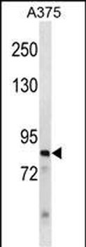 ZNF148 Antibody(N-term)