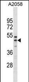 RFFL Antibody(C-term)