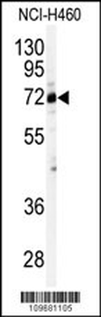 Cleavage stimulation factor 2 (CSTF2) Antibody (N-term)