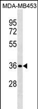 STX11 Antibody(N-term)