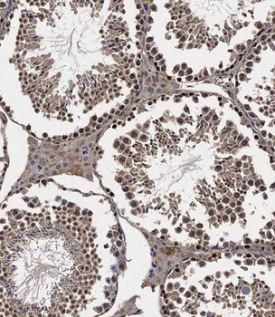 Mouse Lats2 Antibody(C-term)