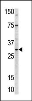 MRPL24 Antibody (C-term)