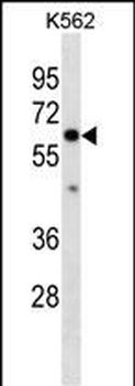 COL10A1 Antibody(N-term)