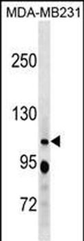 RBL1 Antibody(C-term)