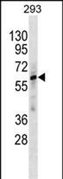 ZNF775 Antibody(C-term)